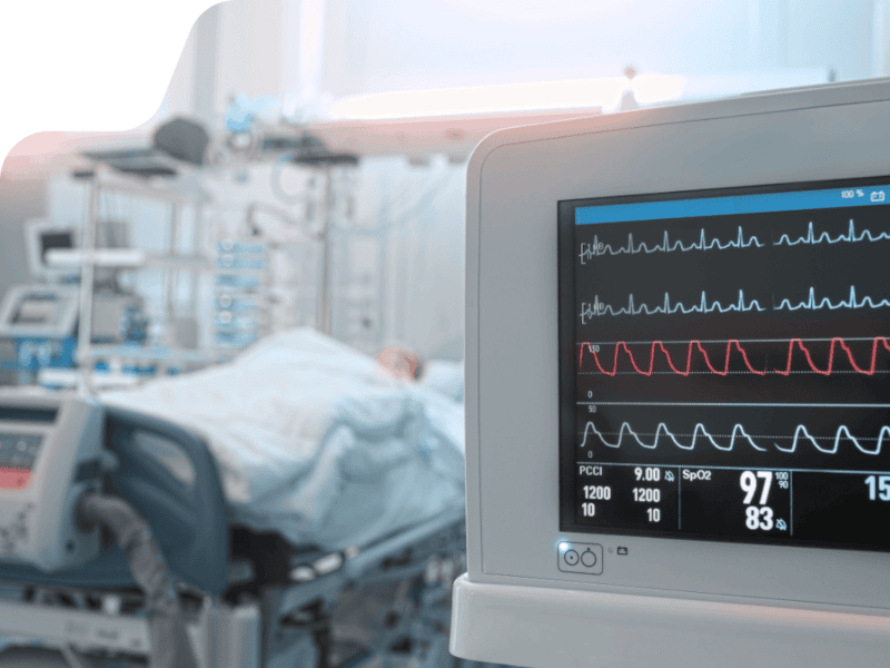 ECG machine in ward setting